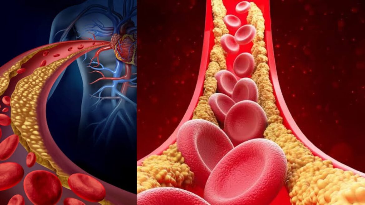 cholesterol keise badhta hai in Hindi